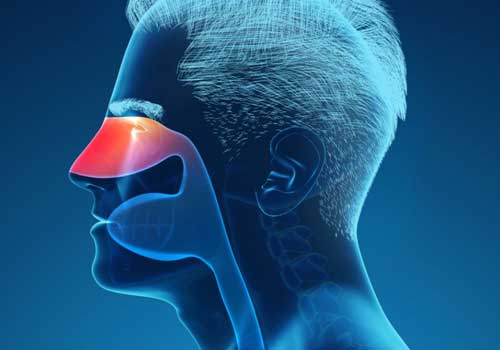 Allergic Rhinitis